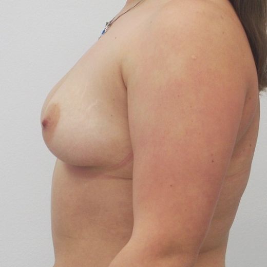 Image before