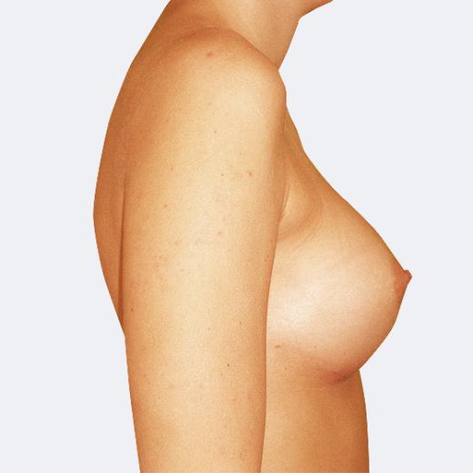 Image after