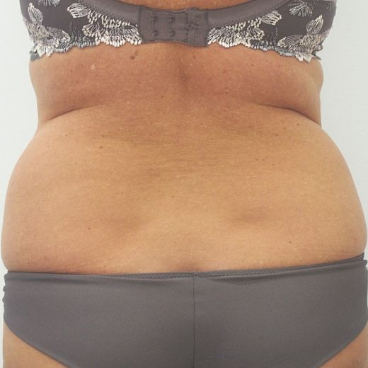 Image before
