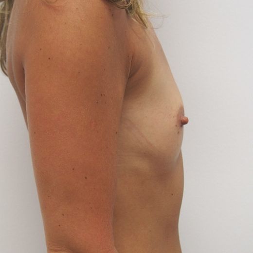 Image before
