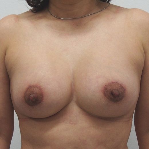 Image after