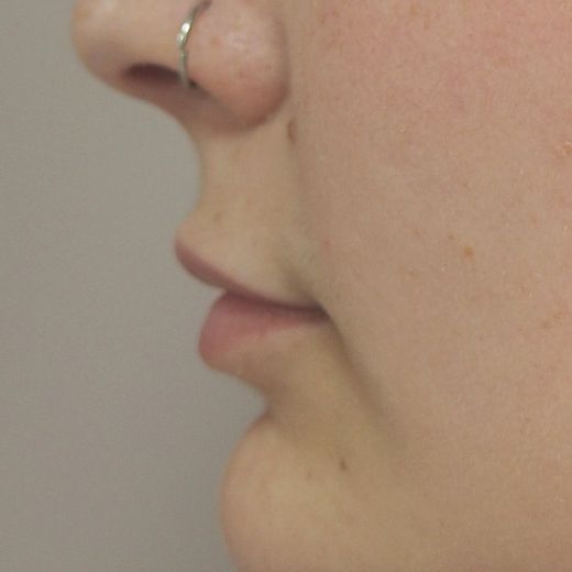 Image before