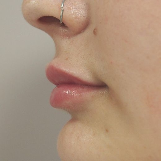 Image after