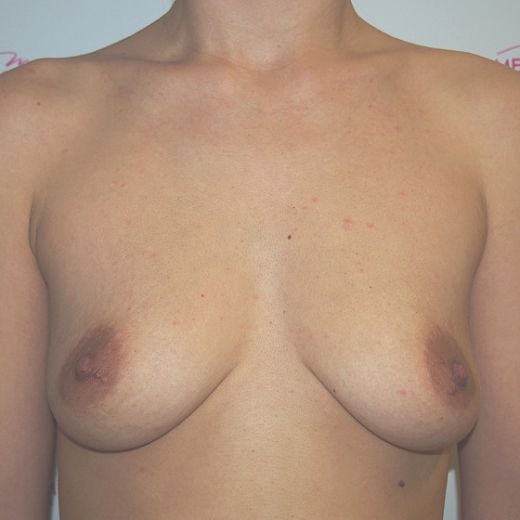 Image before