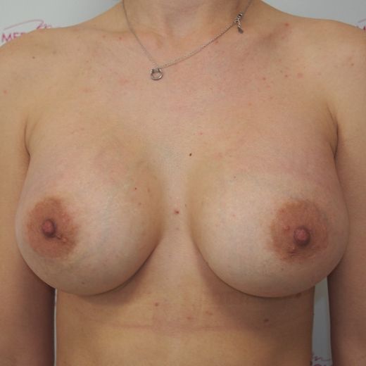 Image after