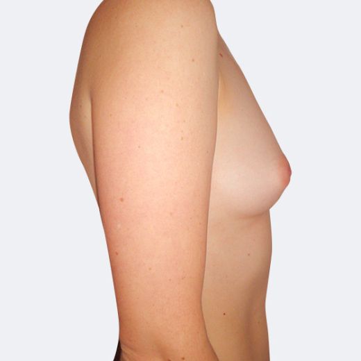 Image before