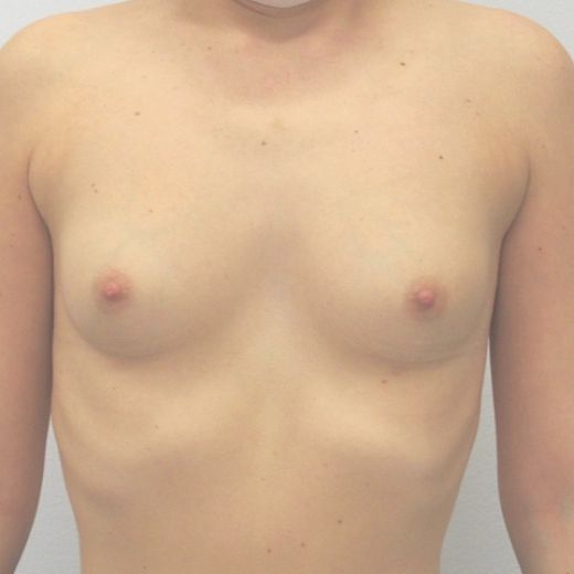 Image before