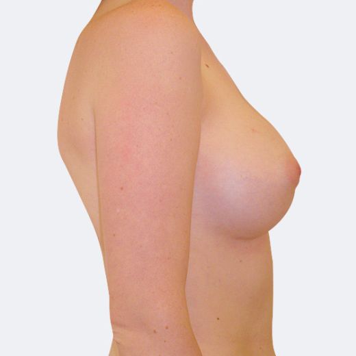 Image after