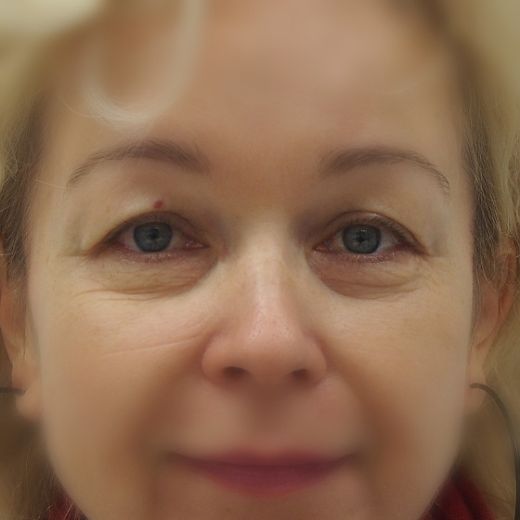 Image before