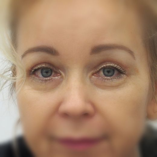 Image after