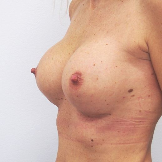 Image after