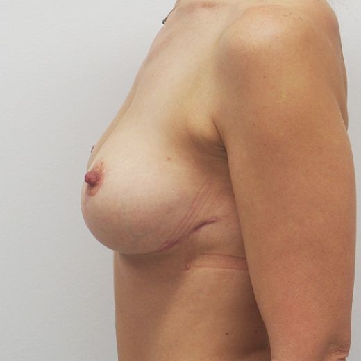 Image after