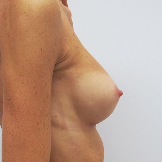 Image after