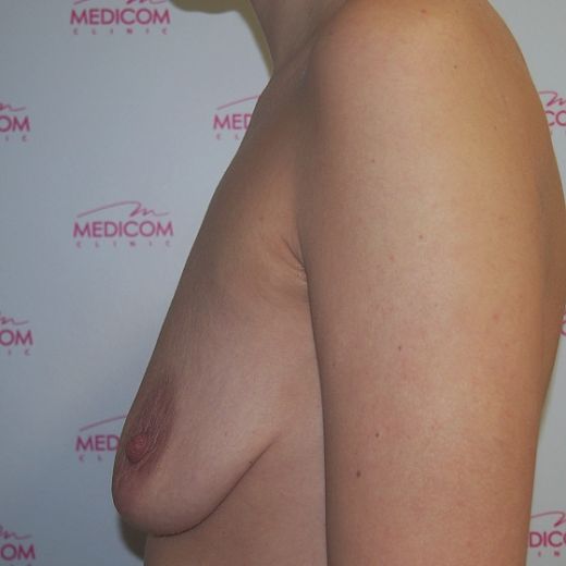 Image before
