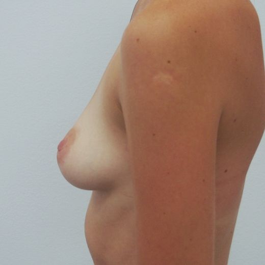 Image before