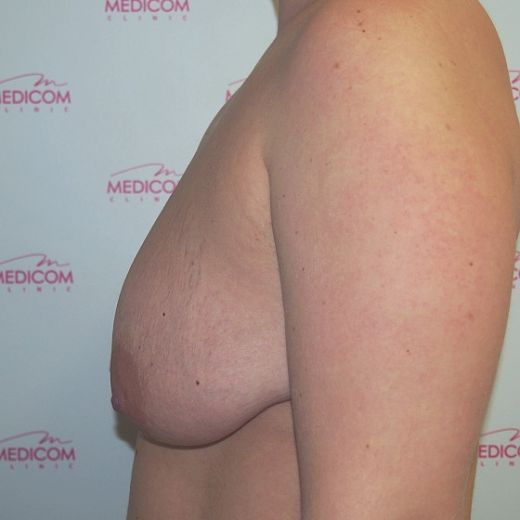 Image before