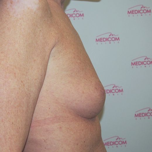Image before