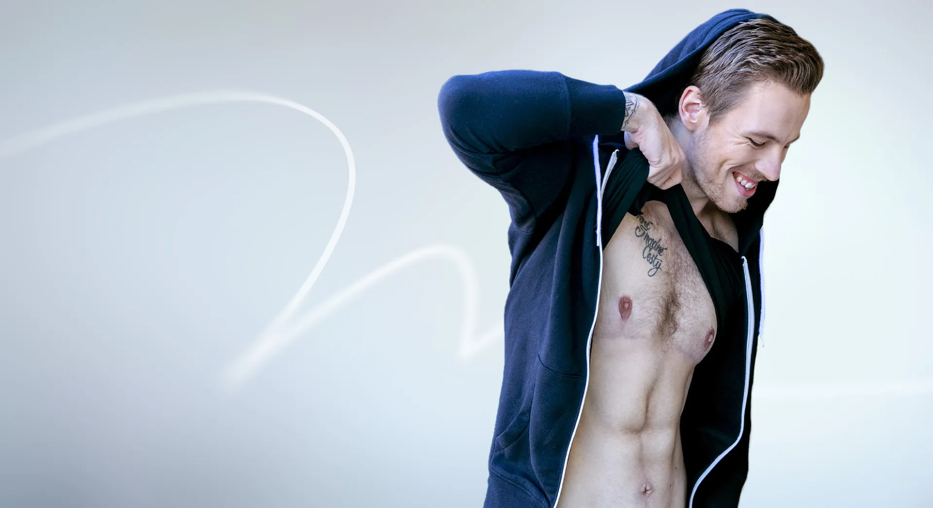 Mr David 27 - Abdominoplasty + gynecomastia