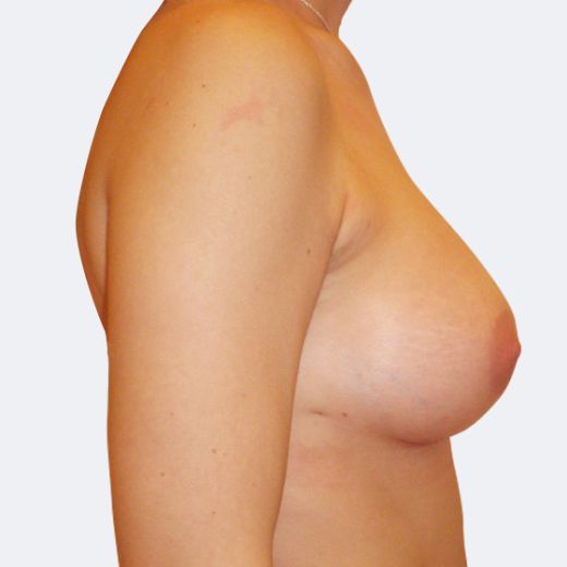 Image after