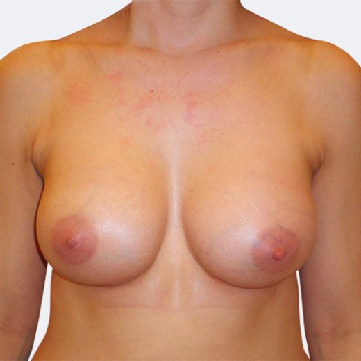 Image after