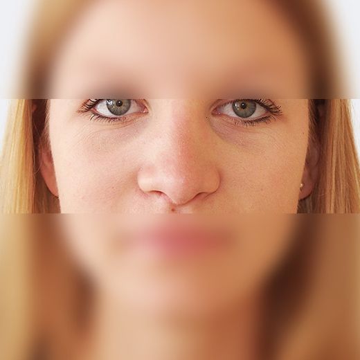 Image after