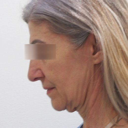 Image before