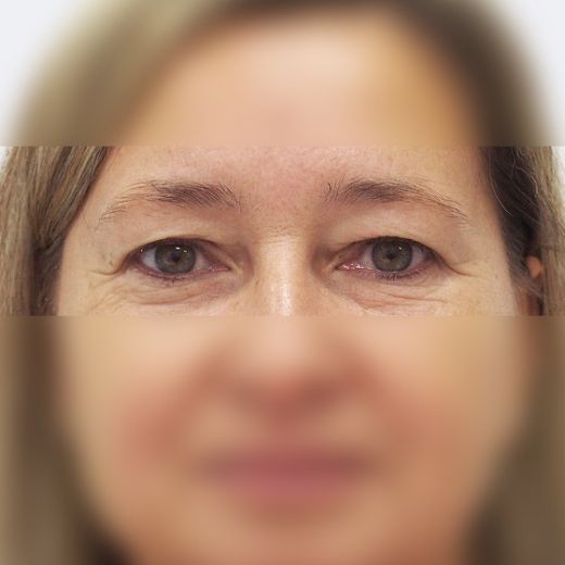 Image before