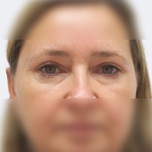 Image after