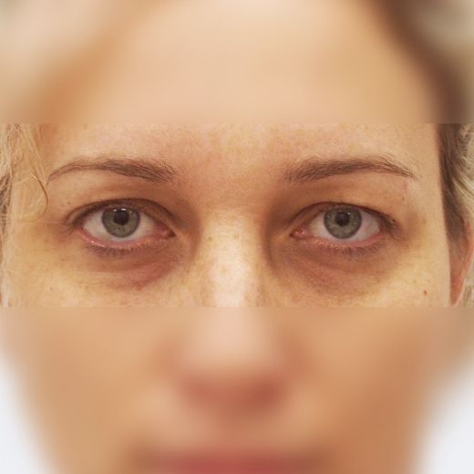 Image before