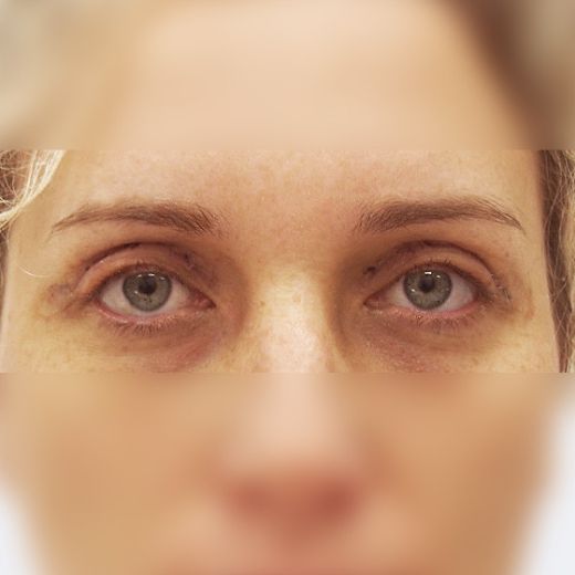 Image after