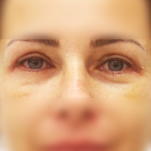 Image after