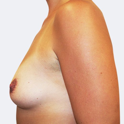 Image before