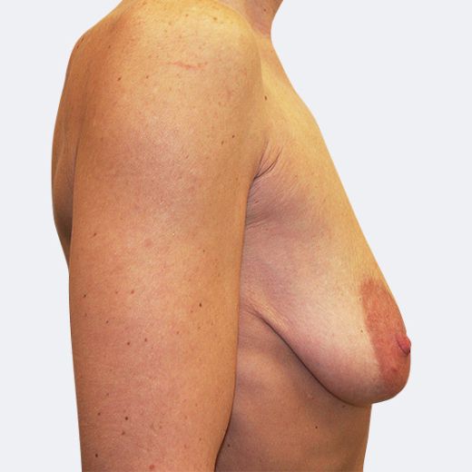 Image before