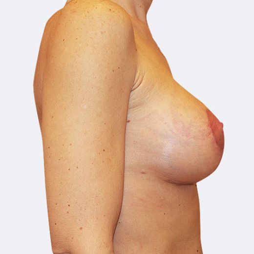 Image after