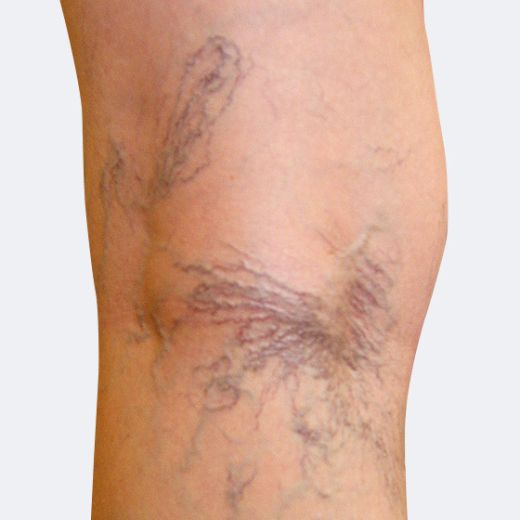 Image before