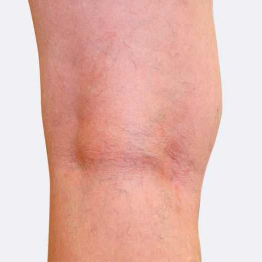 Image after