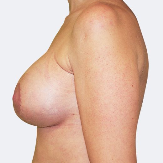 Image after