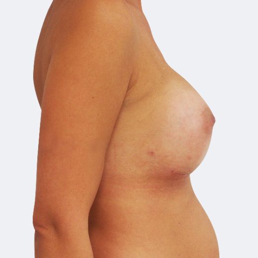 Image after