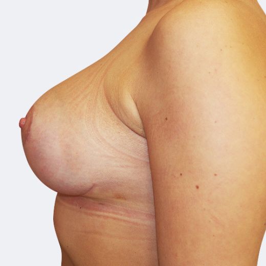 Image after