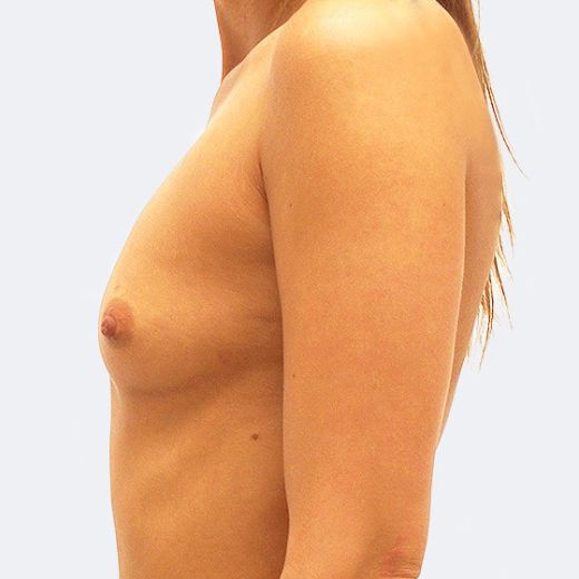 Image before
