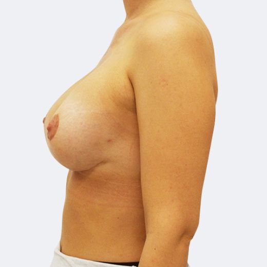 Image after