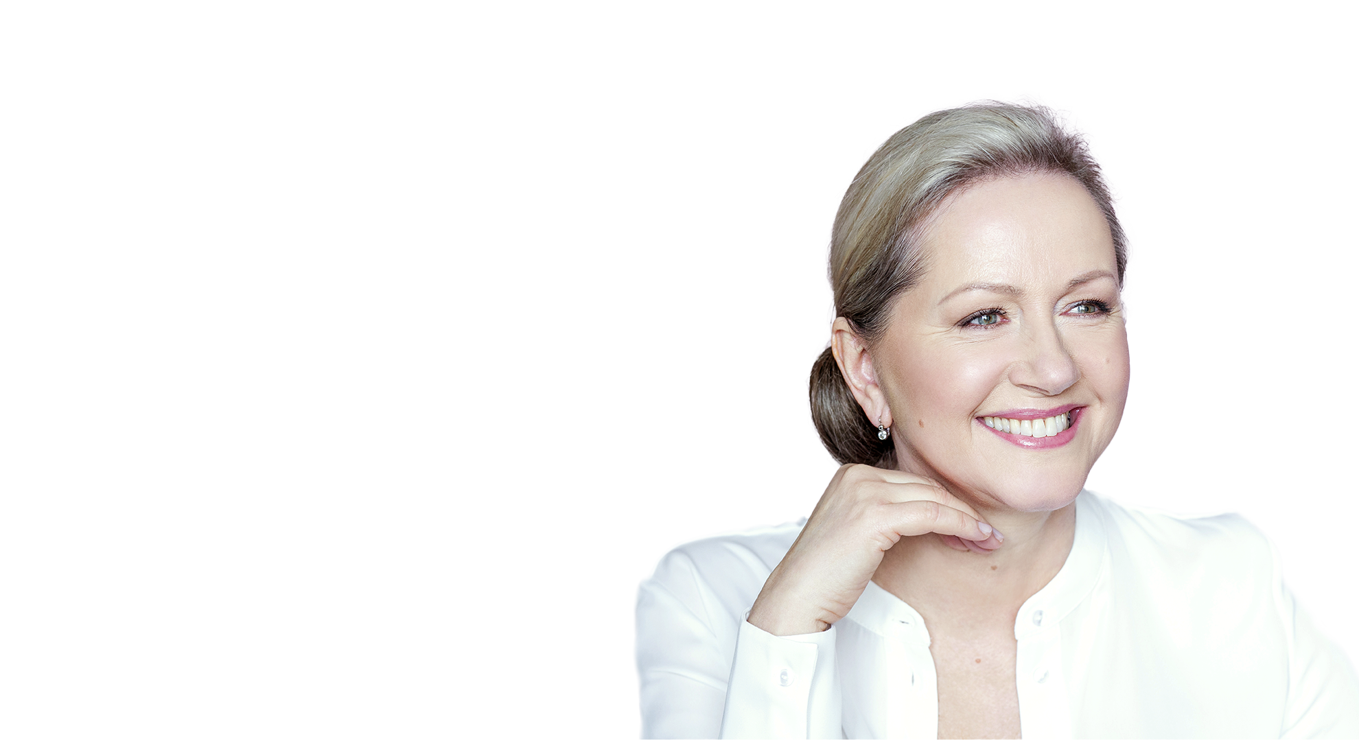 Mrs. Lucie 56 - MyFaceLift Facial Rejuvenation