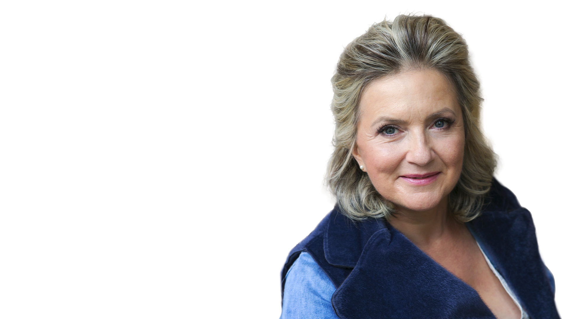 Mrs. Jitka 56 - Facelift and necklift with upper and lower eyelid surgery